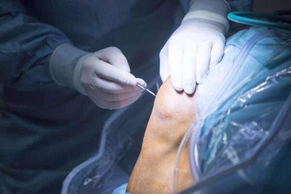 Meniscus Repair Surgery | Colorado Springs Orthopaedic Group