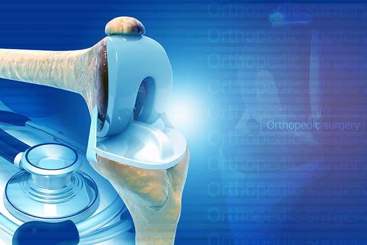 Hip Replacement - Comprehensive Orthopaedics