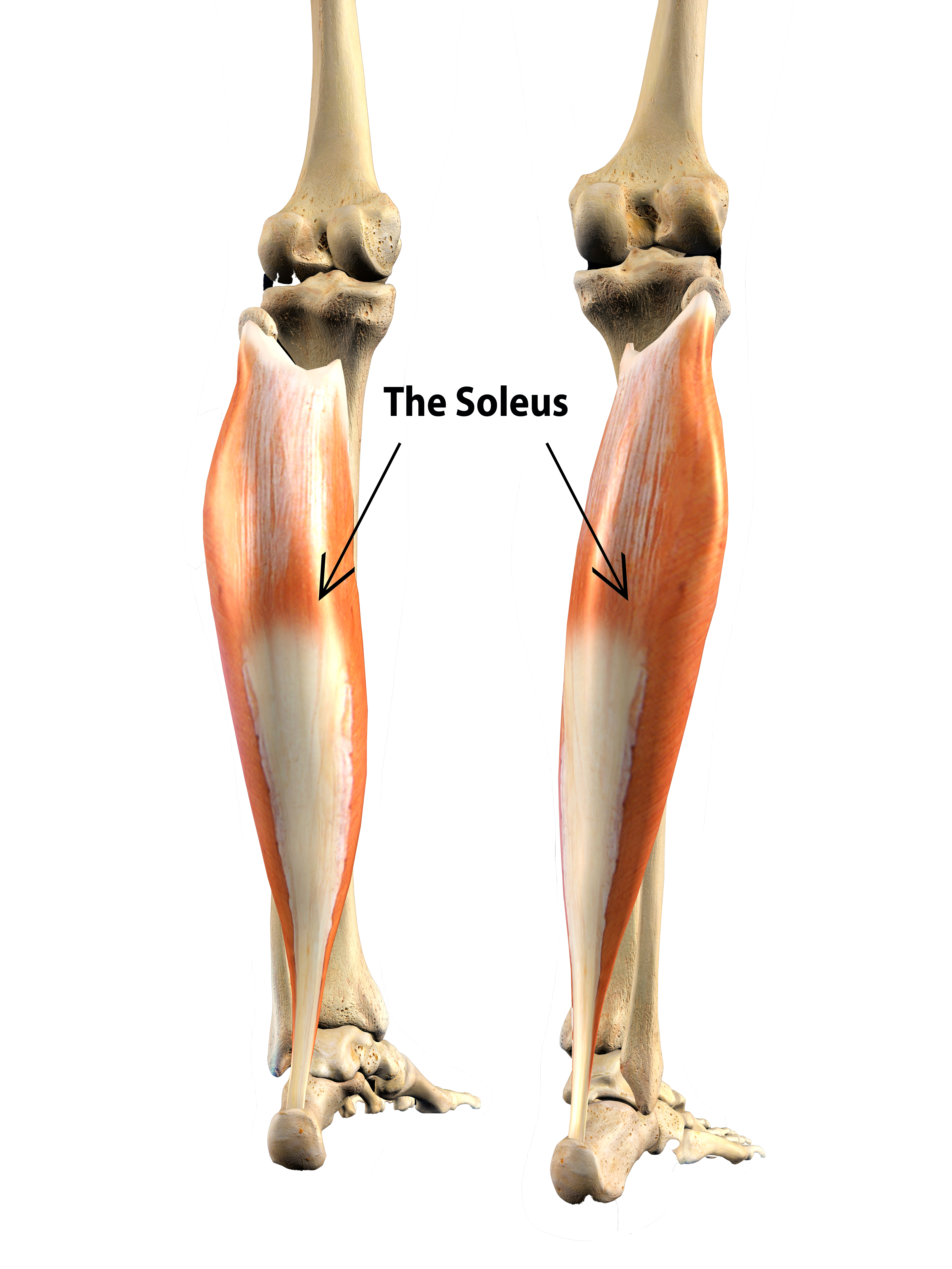 Soulern Plantar Fasciitis Night Splint 2 Pack Drop Foot Orthotic